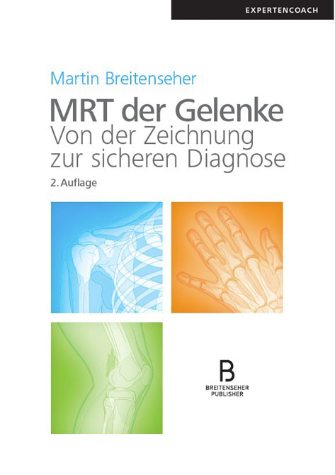 MRT der Gelenke