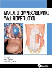 Cover Manual of Complex Abdominal Wall Reconstruction