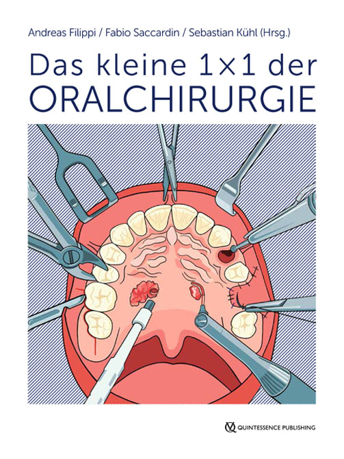 Das kleine 1×1 der Oralchirurgie