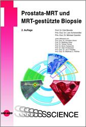 Cover Prostata-MRT und MRT-gestützte Biopsie