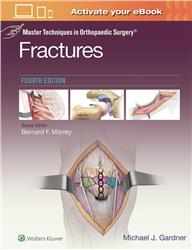 Cover Fractures