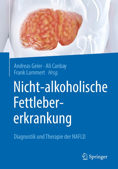 Nicht-alkoholische Fettlebererkrankung