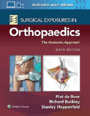 Surgical Exposures in Orthopaedics