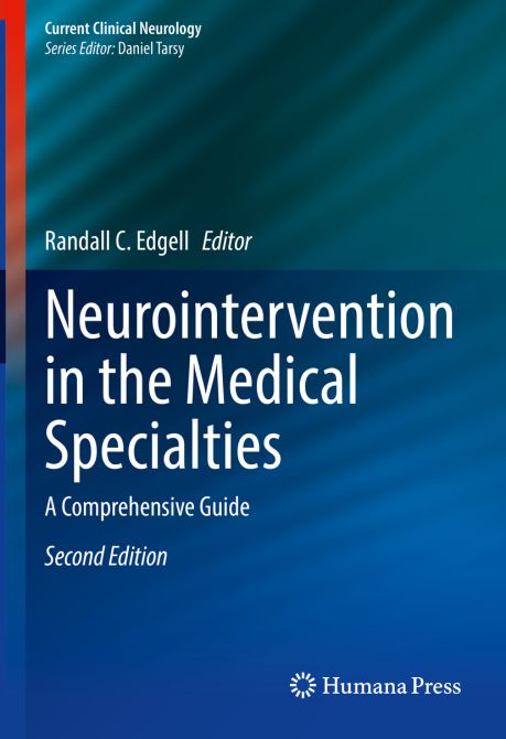 Neurointervention in the Medical Specialties