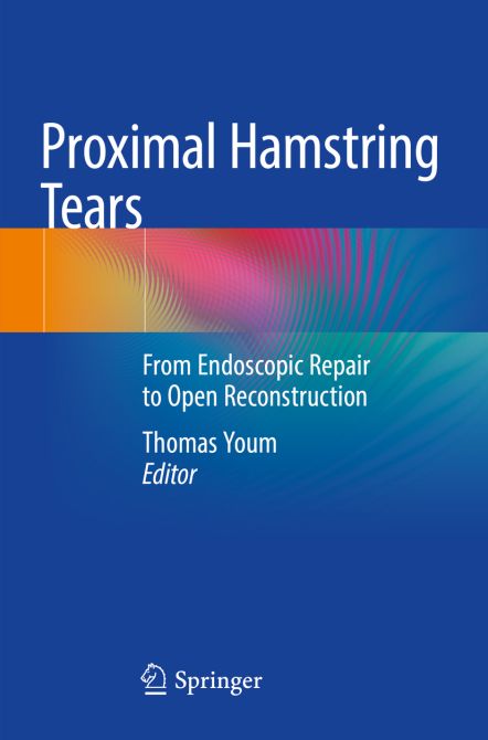 Proximal Hamstring Tears