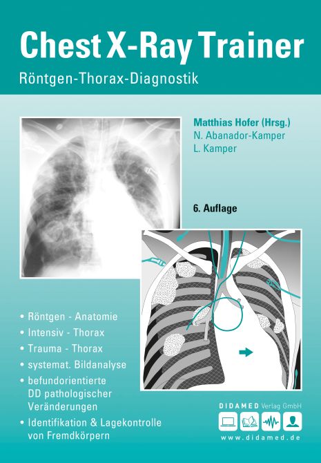 Chest X-Ray Trainer