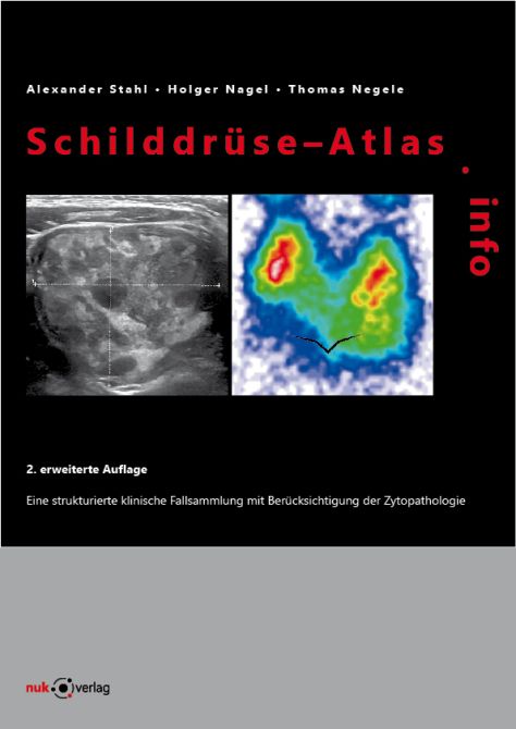 Schilddrüse-Atlas.info