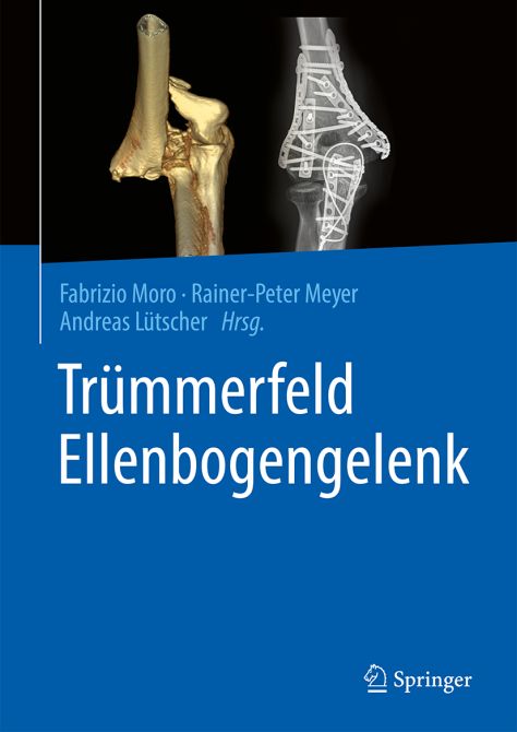 Trümmerfeld Ellenbogengelenk