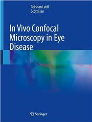 Cover In Vivo Confocal Microscopy in Eye Disease