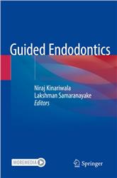 Cover Guided Endodontics