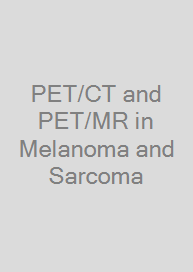 PET/CT and PET/MR in Melanoma and Sarcoma