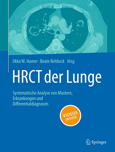 HRCT der Lunge