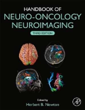 Handbook of Neuro-Oncology Neuroimaging