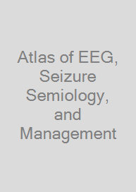 Atlas of EEG, Seizure Semiology, and Management