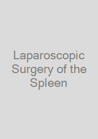 Laparoscopic Surgery of the Spleen