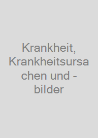 Krankheit, Krankheitsursachen und -bilder