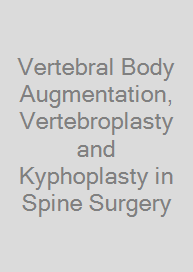 Vertebral Body Augmentation, Vertebroplasty and Kyphoplasty in Spine Surgery
