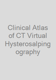Clinical Atlas of CT Virtual Hysterosalpingography