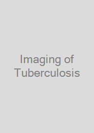 Imaging of Tuberculosis