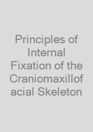 Principles of Internal Fixation of the Craniomaxillofacial Skeleton