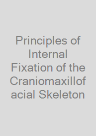 Cover Principles of Internal Fixation of the Craniomaxillofacial Skeleton