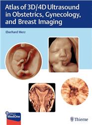 Cover Atlas of 3D and 4D Ultrasound Imaging: Principles and Practice