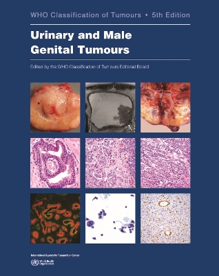 WHO Classification of Tumours of the Urinary System and Male Genital Organs