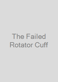 The Failed Rotator Cuff