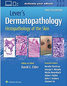 Lever's Histopathology of the Skin