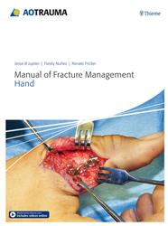 Cover AO Trauma Manual of Fracture Management - Hand