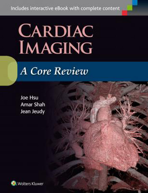 Cardiac Imaging