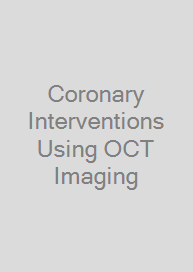 Coronary Interventions Using OCT Imaging