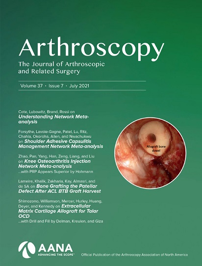 Arthroscopy