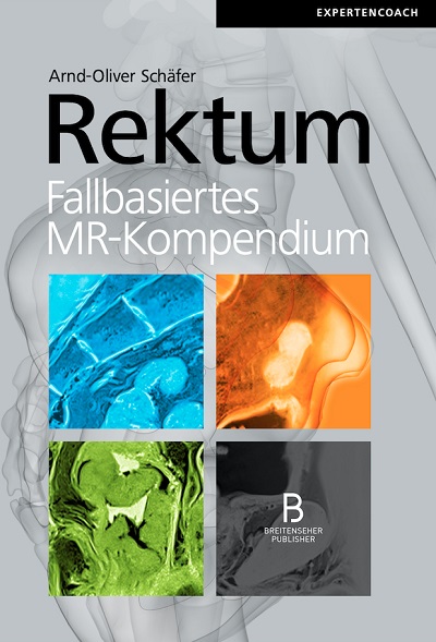 Rektum