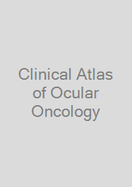 Cover Clinical Atlas of Ocular Oncology