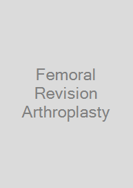 Femoral Revision Arthroplasty