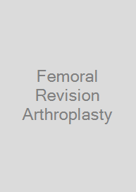 Cover Femoral Revision Arthroplasty