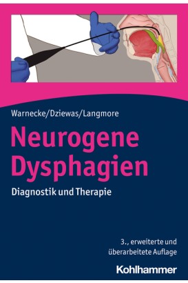 Neurogene Dysphagien