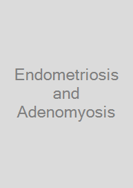 Cover Endometriosis and Adenomyosis