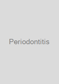 Cover Periodontitis