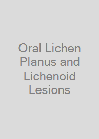 Cover Oral Lichen Planus and Lichenoid Lesions
