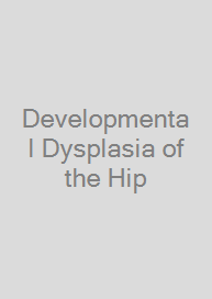 Developmental Dysplasia of the Hip