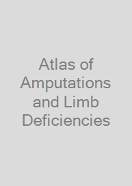 Atlas of Amputations and Limb Deficiencies