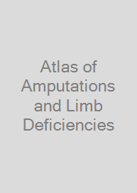 Cover Atlas of Amputations and Limb Deficiencies