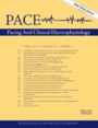 PACE - Pacing and Clinical Electrophysiology