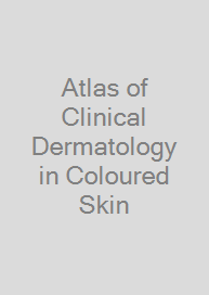 Atlas of Clinical Dermatology in Coloured Skin