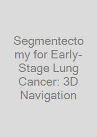 Cover Segmentectomy for Early-Stage Lung Cancer: 3D Navigation