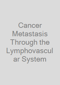 Cancer Metastasis Through the Lymphovascular System