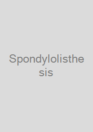 Cover Spondylolisthesis