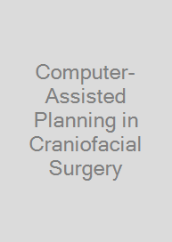 Computer-Assisted Planning in Craniofacial Surgery